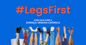 Verão e saúde venosa: Campanha partilha dicas essenciais para evitar os sintomas